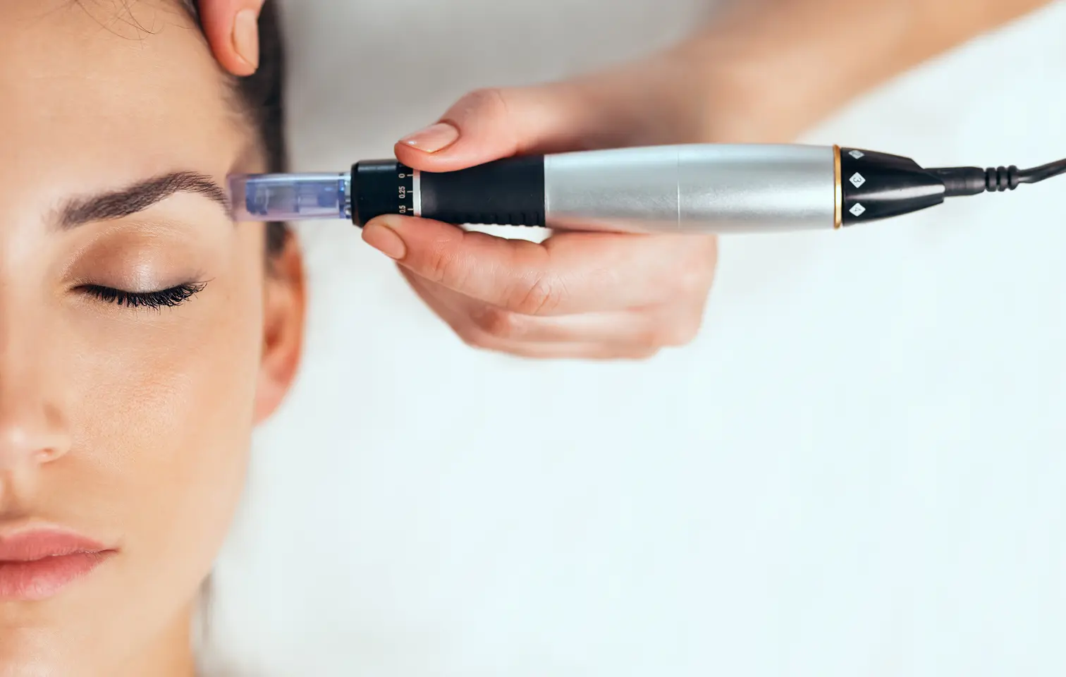 1 NEED Pro Kollagén Indukció terápia